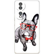 Чохол BoxFace Honor 70 