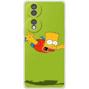 Чохол BoxFace Honor 70 