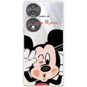 Прозорий чохол BoxFace Honor 70 Mister M