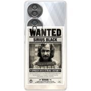 Прозорий чохол BoxFace Honor 70 Sirius Black