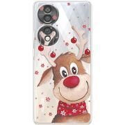 Прозорий чохол BoxFace Honor 70 Winter Deer