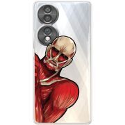 Прозорий чохол BoxFace Honor 70 Титан