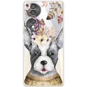 Прозорий чохол BoxFace Honor 70 