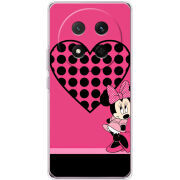 Чохол BoxFace Honor Magic 7 Lite 5G 