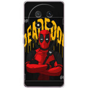 Чохол BoxFace Honor Magic 7 Lite 5G 