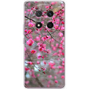 Чохол BoxFace Honor Magic 7 Lite 5G 