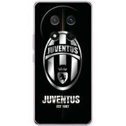 Чохол BoxFace Honor Magic 7 Lite 5G 