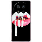 Чохол BoxFace Honor Magic 7 Lite 5G 