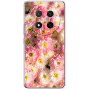 Чохол BoxFace Honor Magic 7 Lite 5G 