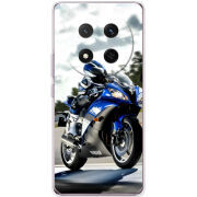 Чохол BoxFace Honor Magic 7 Lite 5G 