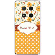 Чохол BoxFace Honor Magic 7 Lite 5G 