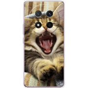 Чохол BoxFace Honor Magic 7 Lite 5G 