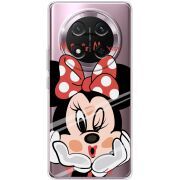 Прозорий чохол BoxFace Honor Magic 7 Lite 5G Lady M