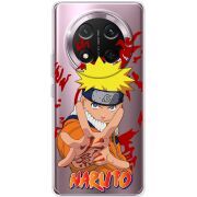 Прозорий чохол BoxFace Honor Magic 7 Lite 5G Naruto