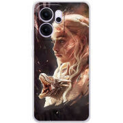 Чохол BoxFace OPPO Reno 14 F 