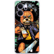 Чохол BoxFace OPPO Reno 14 FS 