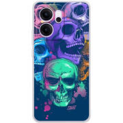 Чохол BoxFace OPPO Reno 14 FS 