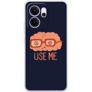 Чохол BoxFace OPPO Reno 14 FS 