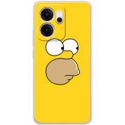 Чохол BoxFace OPPO Reno 14 FS 