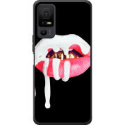 Чохол BoxFace TCL 40 NxtPaper 5G 