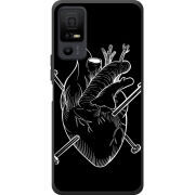 Чохол BoxFace TCL 40 NxtPaper 5G 