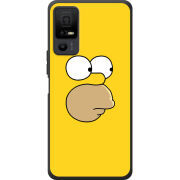 Чохол BoxFace TCL 40 NxtPaper 5G 