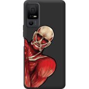 Чорний чохол BoxFace TCL 40 NxtPaper 5G Титан