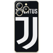 Чохол BoxFace Realme Note 70 FC J