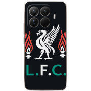 Чохол BoxFace Xiaomi 15T Pro L. F. C.