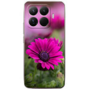 Чохол BoxFace Xiaomi 15T Pro 