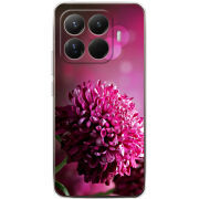 Чохол BoxFace Xiaomi 15T Pro 