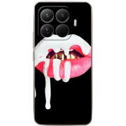 Чохол BoxFace Xiaomi 15T Pro 