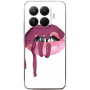 Чохол BoxFace Xiaomi 15T Pro 