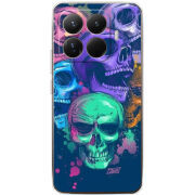 Чохол BoxFace Xiaomi 15T Pro 