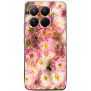 Чохол BoxFace Xiaomi 15T Pro 