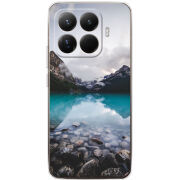 Чохол BoxFace Xiaomi 15T Pro 