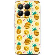 Чохол BoxFace Xiaomi 15T Pro 