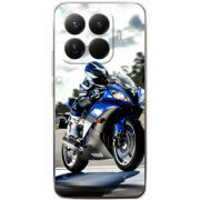 Чохол BoxFace Xiaomi 15T Pro 