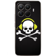 Чохол BoxFace Xiaomi 15T Pro 