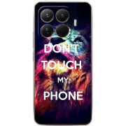 Чохол BoxFace Xiaomi 15T Pro 