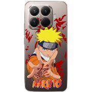 Прозорий чохол BoxFace Xiaomi 15T Pro Naruto