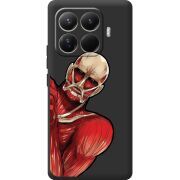 Чорний чохол BoxFace Xiaomi 15T Pro Титан