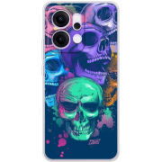 Чохол BoxFace OPPO Reno 14 5G 