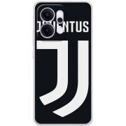 Чохол BoxFace OPPO Reno 14 Pro 5G FC J