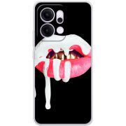 Чохол BoxFace OPPO Reno 14 Pro 5G 