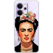 Прозорий чохол BoxFace OPPO Reno 14 Pro 5G Фрида Кало