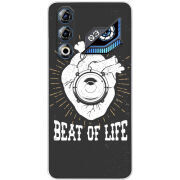 Чохол BoxFace Nubia Neo 3 GT 5G 