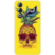 Чохол BoxFace Nubia Neo 3 GT 5G Pineapple Skull