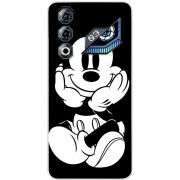 Чохол BoxFace Nubia Neo 3 GT 5G 