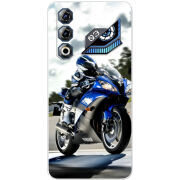 Чохол BoxFace Nubia Neo 3 GT 5G 